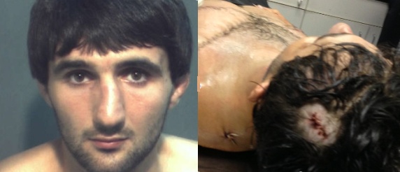 Ibragim Todashev and autopsy photo showing FBI agent's "kill shot" to the head during a midnight household "interrogation"