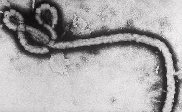 Ebola virus